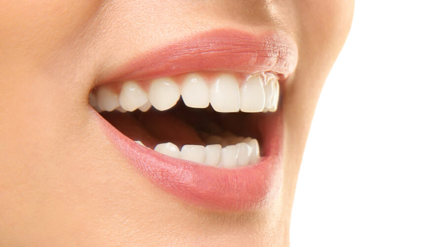 Bonding Uygulamaları