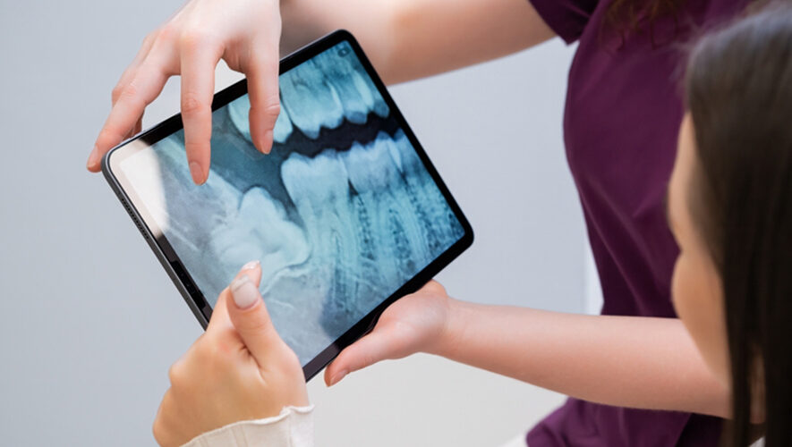 Radiologie et imagerie dentaires