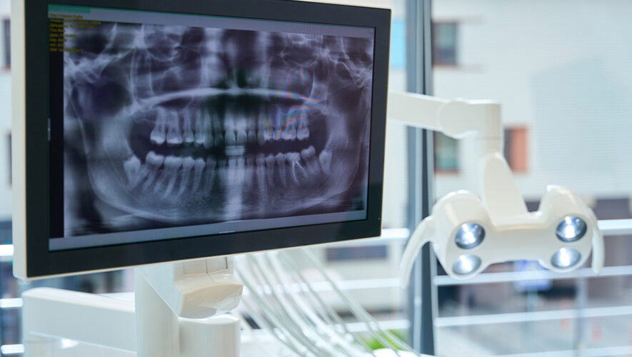 Radiovisiographie numérique