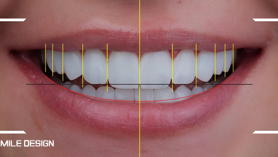 Estetik Diş Hekimliği