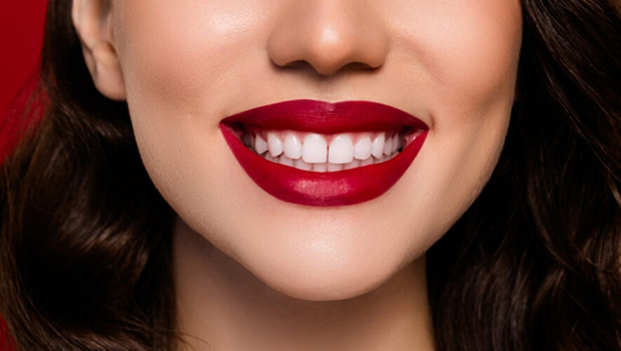 Hollywood Gülüşü