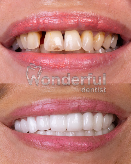 1-wonderful-dentist-oral-dental-health-center-2