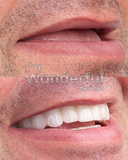 2-wonderful-dentist-oral-dental-health-center-2
