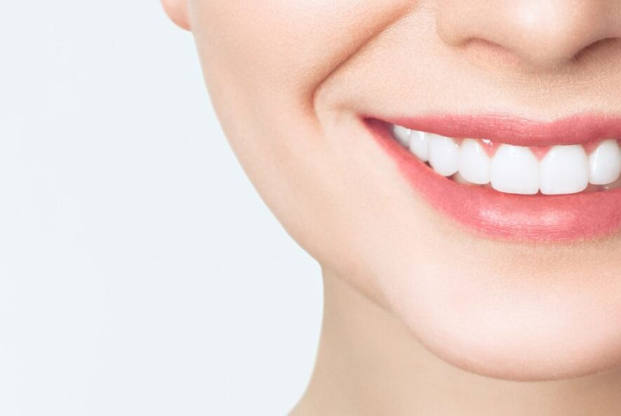 Porselen Dolgu Nedir?