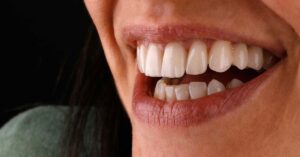 Zirkonyum Kaplama Nedir?