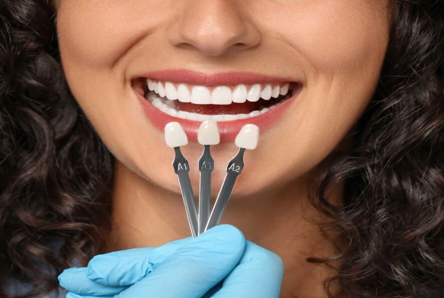 Zirkonyum Kaplama Nedir?