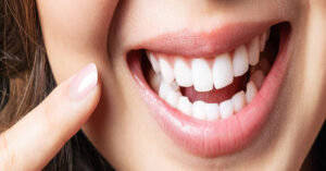 Diş Eti Estetiği Nedir