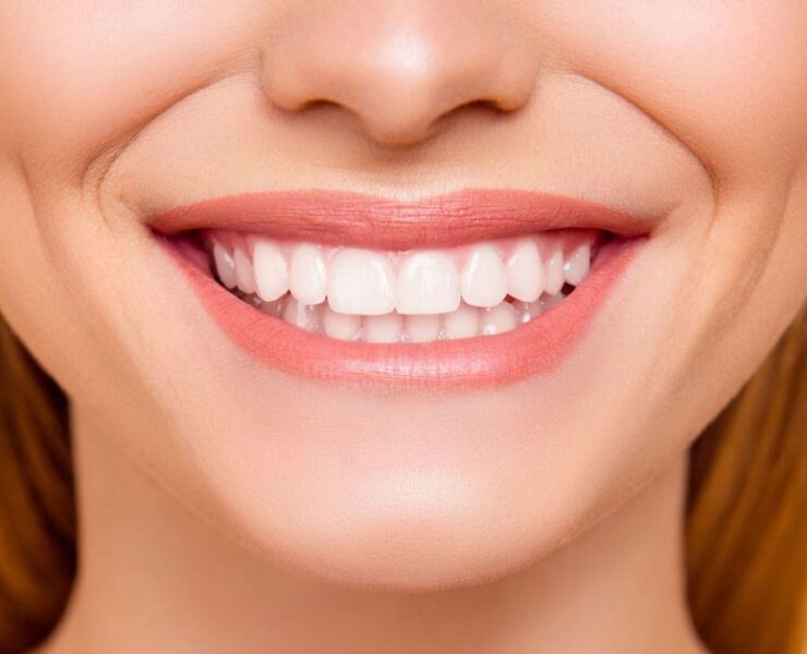 Diş Eti Estetiği Nasıl Yapılır?